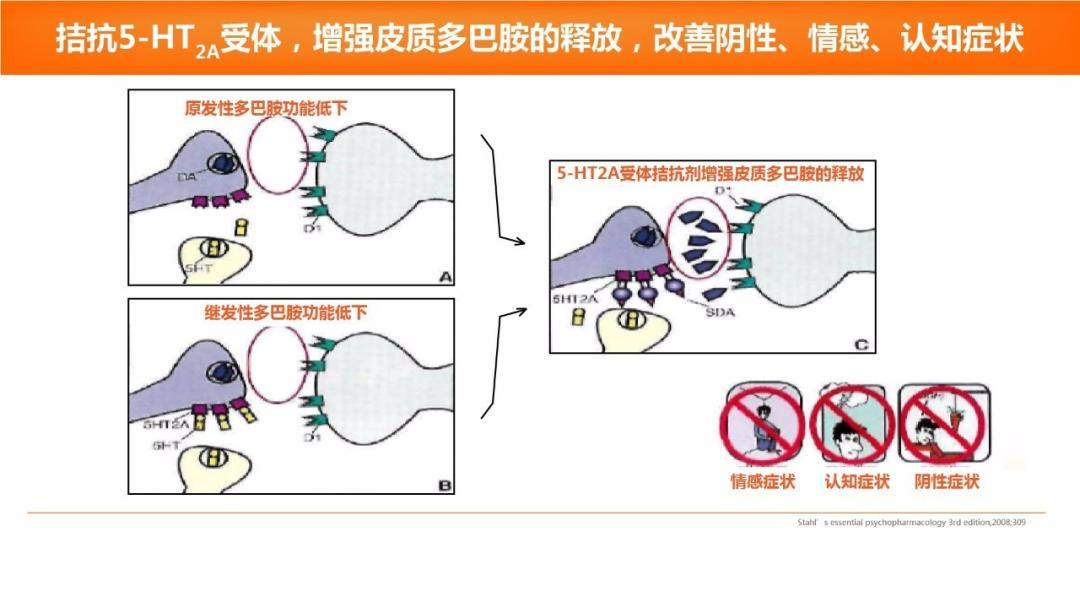 精神分裂症:多巴胺功能紊乱机制参考文献:1.newmanwj, et al.